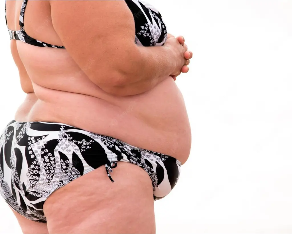 Can Belly Fat Cause Bladder Problems